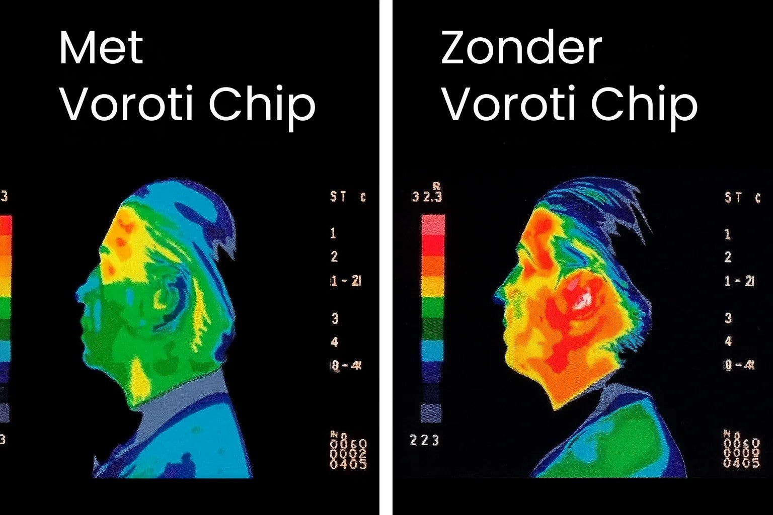 Voroti-chip